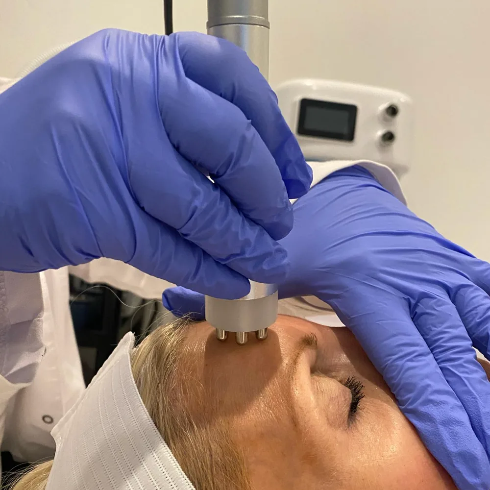 A multi-probe microcurrent handpiece being used on a client’s forehead during a facelifting treatment