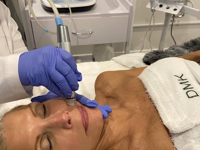 A DMK enzyme treatment being performed on a client at MySkin in Milford, Connecticut